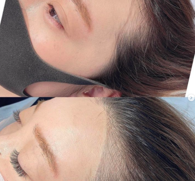 Hairline Tattoo Melbourne